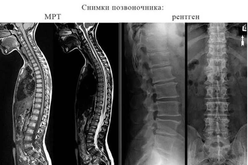 Рентген поясничного отдела фото Рентген - медицинский центр "МареМед"