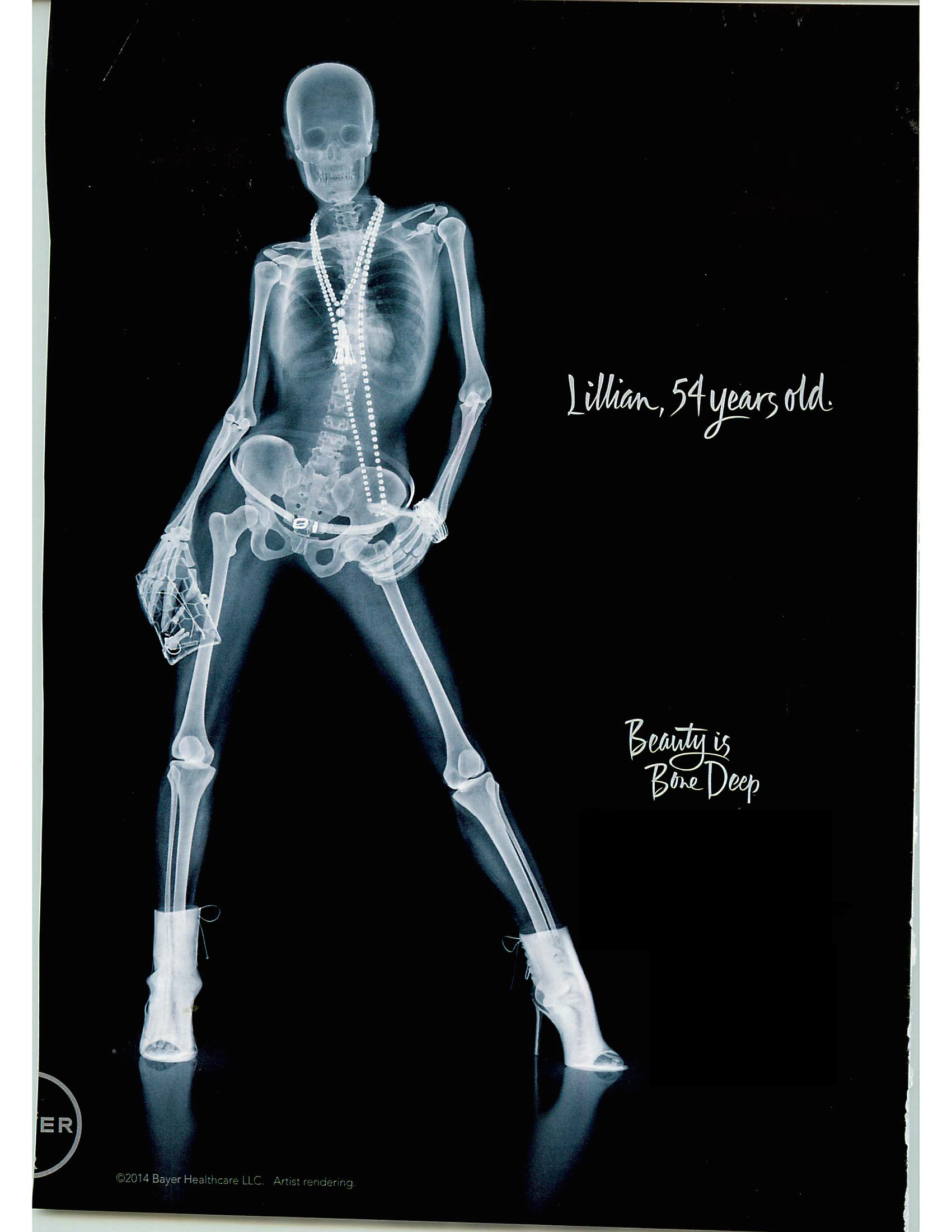 Рентген смешные фото Pin on SKELETAL Anatomy art, Xray art, Anatomy reference