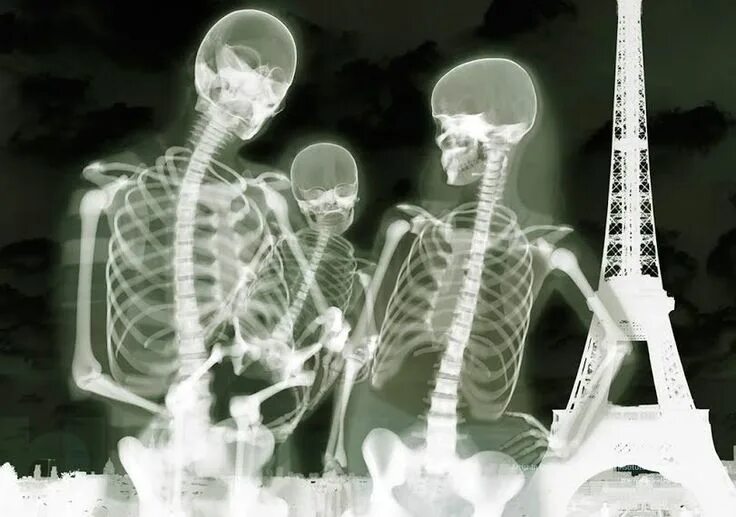 Рентген смешные фото These Creepy X-Rays Will Make You Look At People In A Whole New Light Рентгеновс