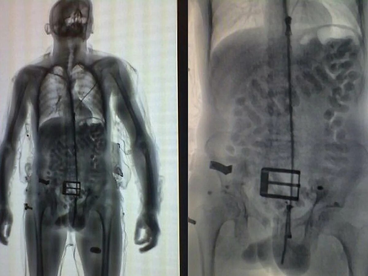 Рентген в аэропорту фото Снимки рентгена в аэропорту - фото