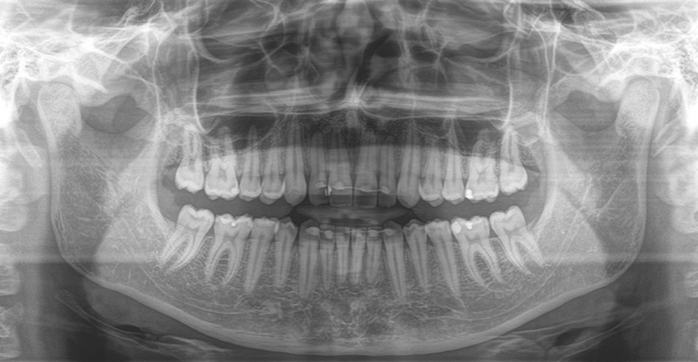 Рентген зубов фото как выглядит Clinical Division of Radiology Clinical Divisions at the School of Dentistry Vie