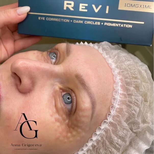 Реви для глаз фото PREPARATORY REVI EYE is a favorite among my ❤ clients Created for the periorbita