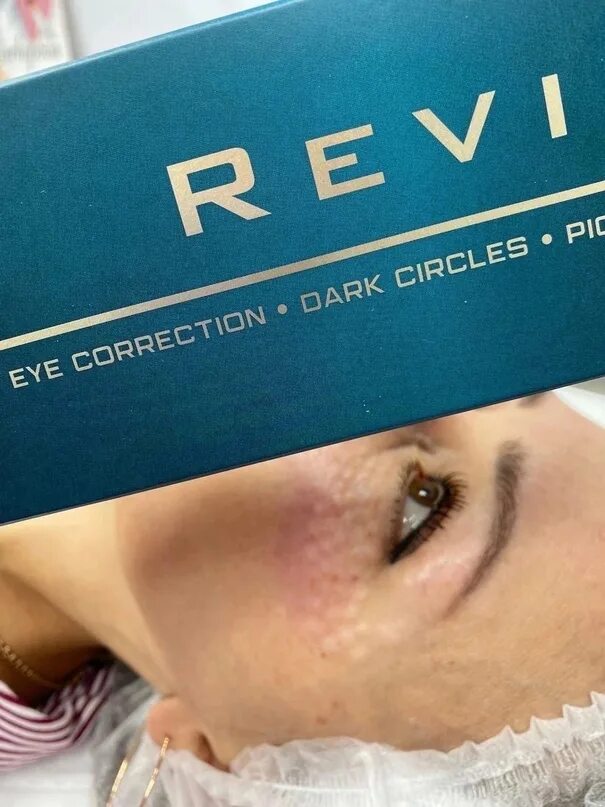 Реви под глаза фото Revi Eye Correction - первый биоревитализант, специально разработанный для корре