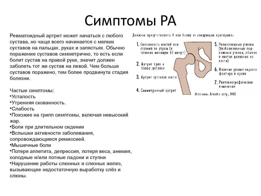 Ревматоидный артрит симптомы фото Признаки ревматоидного артрита у женщин: отличия от мужчин