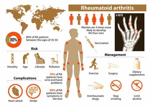 Ревматоидный артрит симптомы фото Arthritis Icon Зображення - огляд 9,895 Стокові фото, векторні зображення й віде