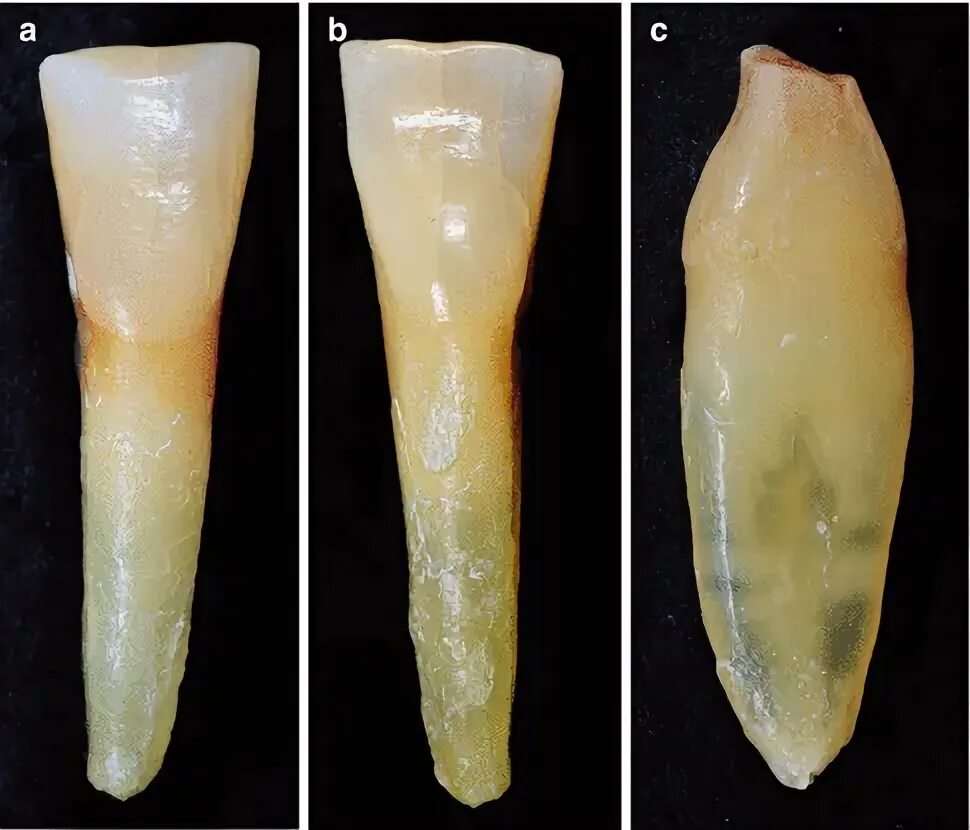 Резец центральный фото Endodontic Morphology and Anatomy of Human Teeth Pocket Dentistry