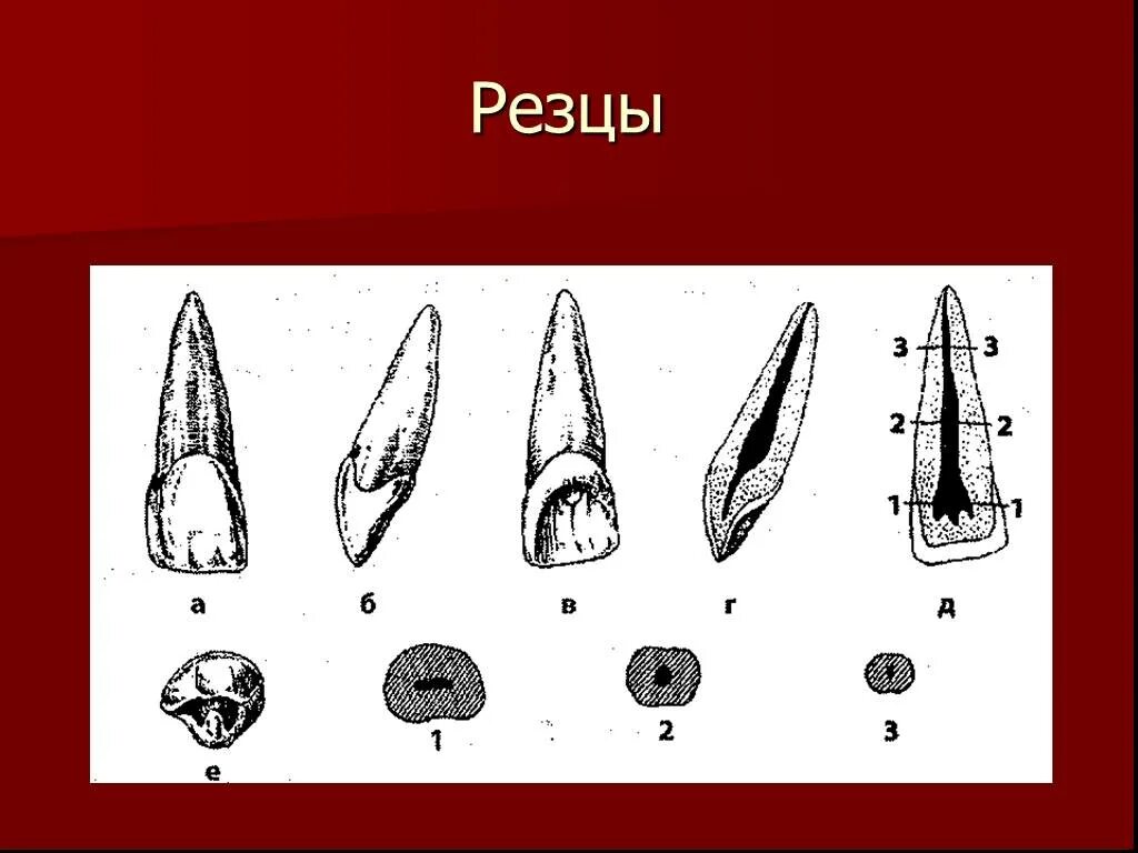 Резец зуб верхний фото Картинки РЕЗЦЫ ВЕРХНЕЙ ЧЕЛЮСТИ