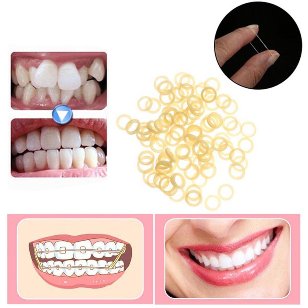 Резинки на зубах фото Orthodontic Orthodontic Braces bands Elastic Rubber Bands Ligation Coil Dental O