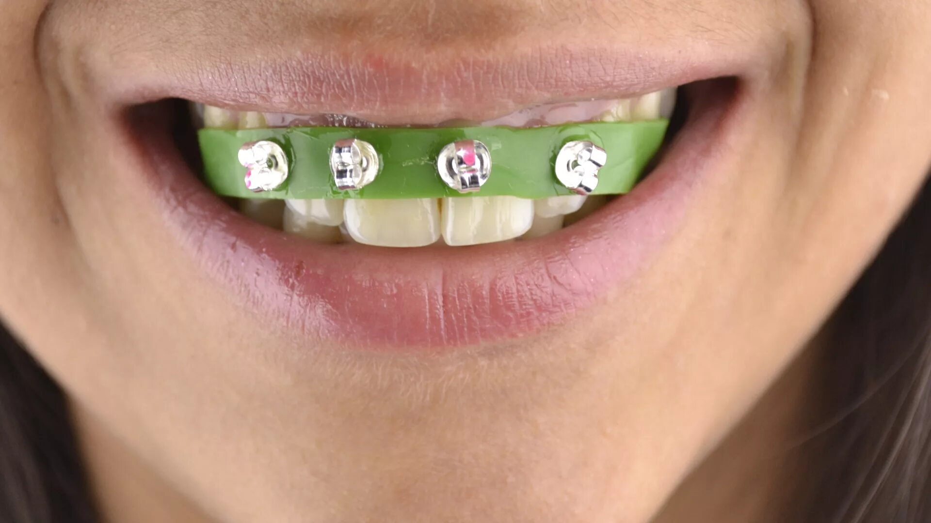 Резинки на зубах фото How to Make Fake Braces: 11 Steps (with Pictures) - wikiHow