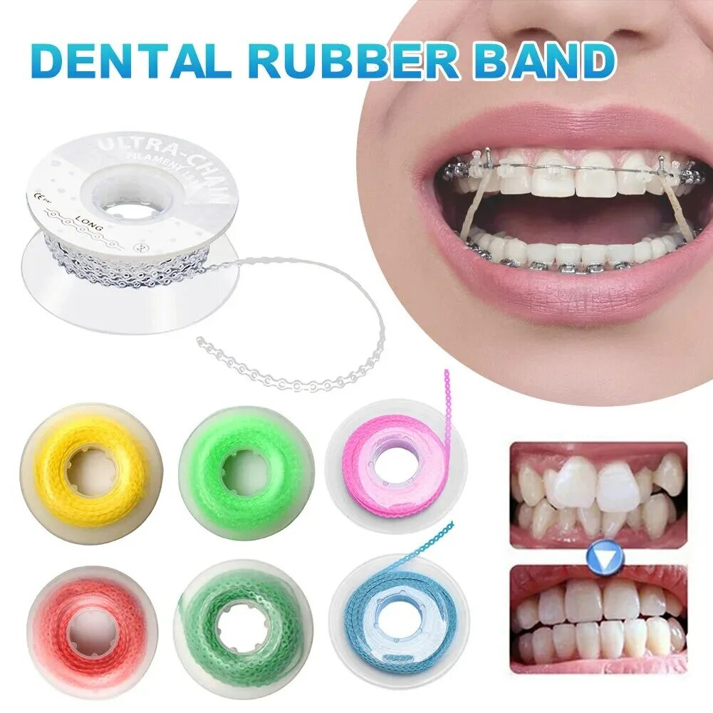 Резинки на зубах фото quot;chain teeth orthodont harga terbaik - Penawaran besar untuk chain teeth ort