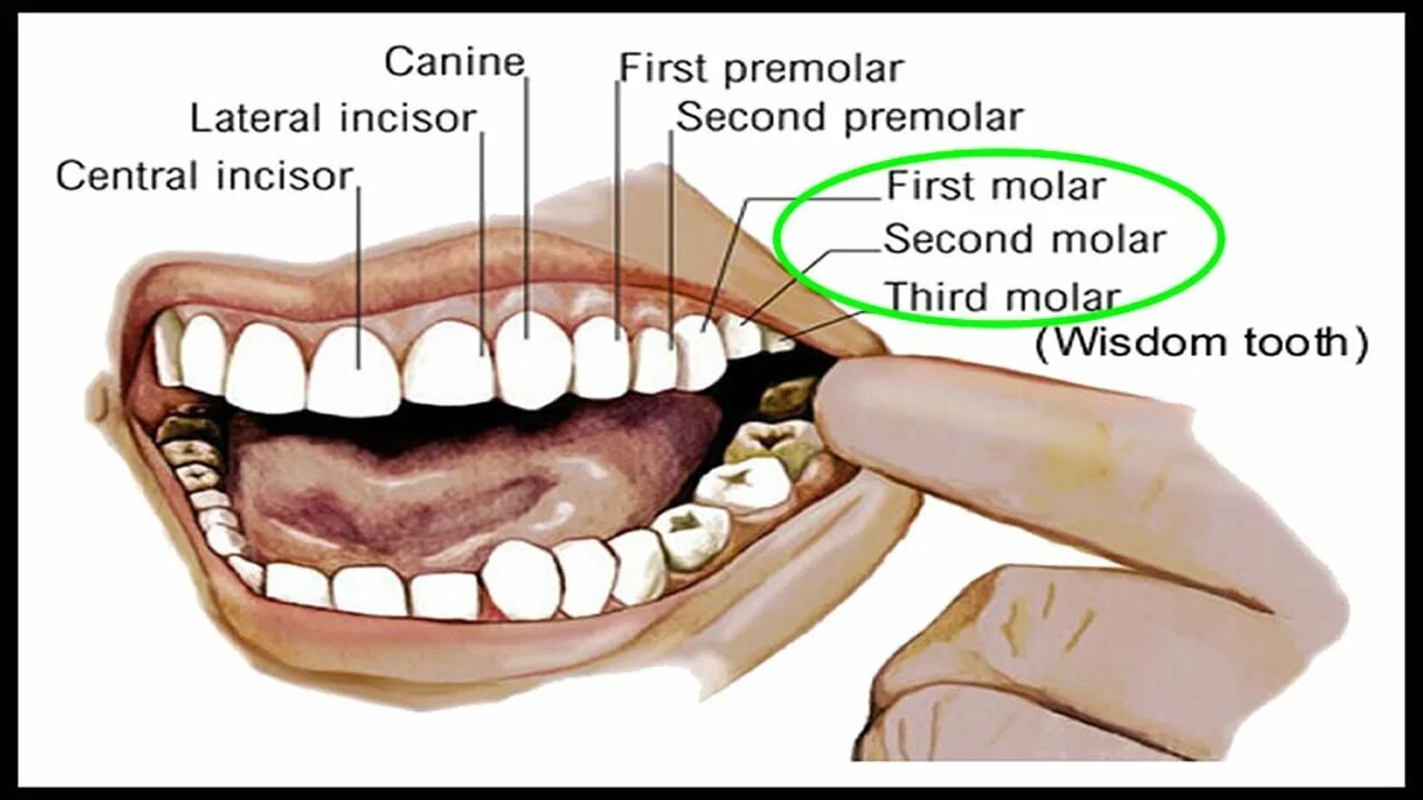 Резцы передние на верхней челюсти высокие фото molar ASL - YouTube