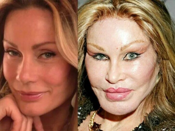 Результаты пластики фото Jocelyn Wildenstein - New York Socialite....now known as 'The Cat Woman' Bad cel